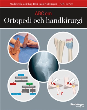 ABC om ortopedi och handkirurgi