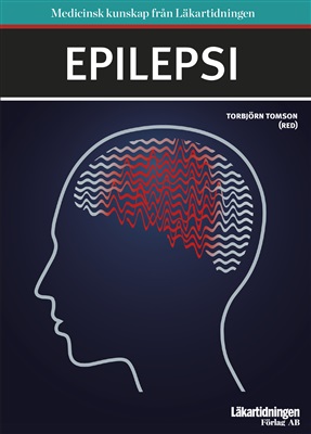 Epilepsi